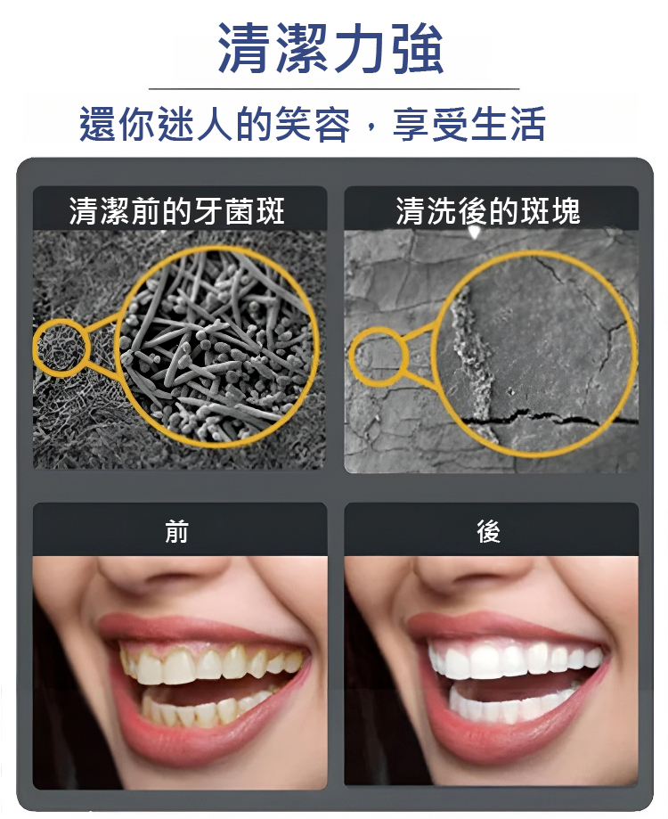翻译件-JC-真超声波洁牙器-1143252_21.jpg