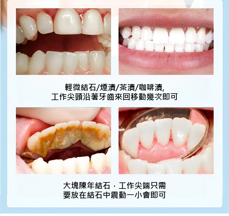 翻译件-JC-真超声波洁牙器-1143252_15.jpg