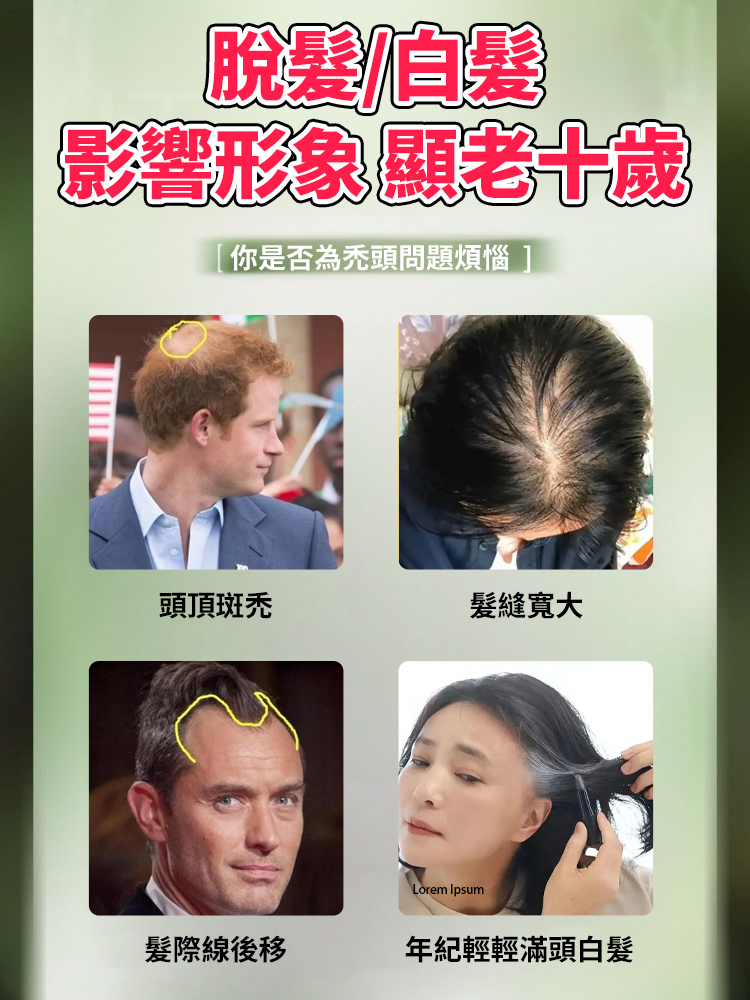 【髮量暴漲】側柏葉烏斯曼草洗髮皂