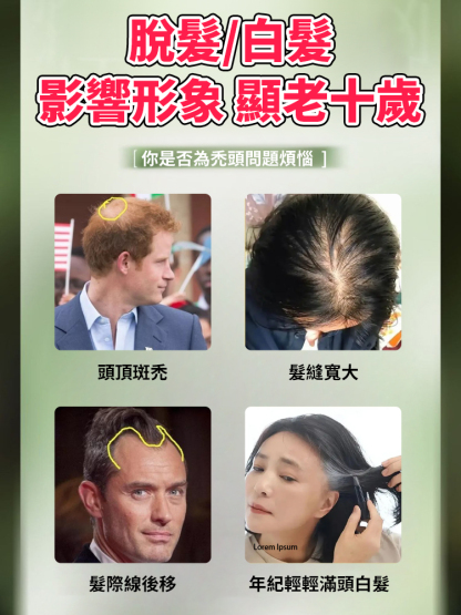 【髮量暴漲】側柏葉烏斯曼草洗髮皂