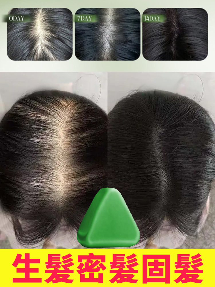 【髮量暴漲】側柏葉烏斯曼草洗髮皂