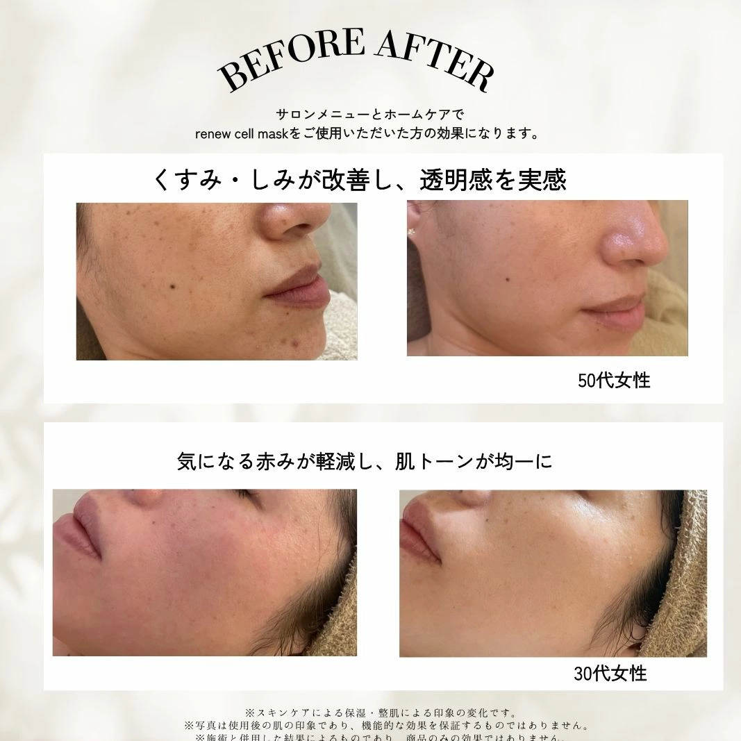 【選べる枚数】ヒト幹細胞 シートマスク パック 1枚 5枚 20枚 30枚ヒト幹細胞シートマスク フェイスマスク マスク パック ヒト幹細胞パック renew cell mask 