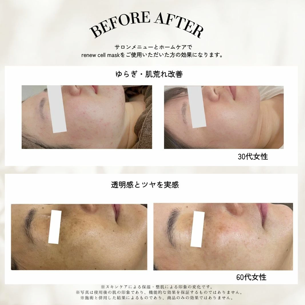 【選べる枚数】ヒト幹細胞 シートマスク パック 1枚 5枚 20枚 30枚ヒト幹細胞シートマスク フェイスマスク マスク パック ヒト幹細胞パック renew cell mask 