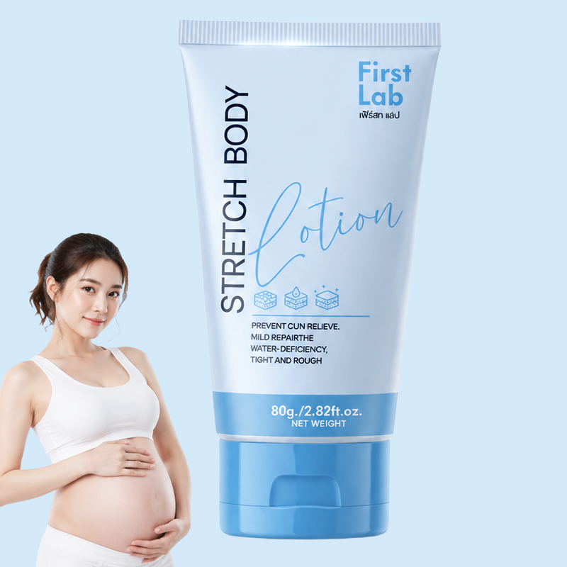 ครีมลดรอยแตกลายเลเซอร์แบบทา ปลอดภัยสำหรับแม่ให้นมบุตร
