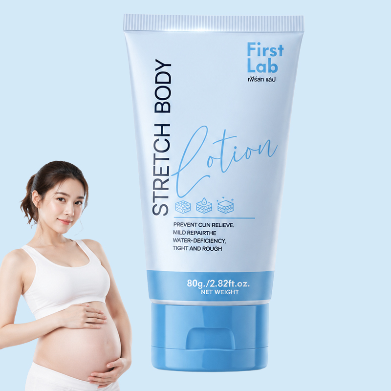 ครีมลดรอยแตกลายเลเซอร์แบบทา ปลอดภัยสำหรับแม่ให้นมบุตร