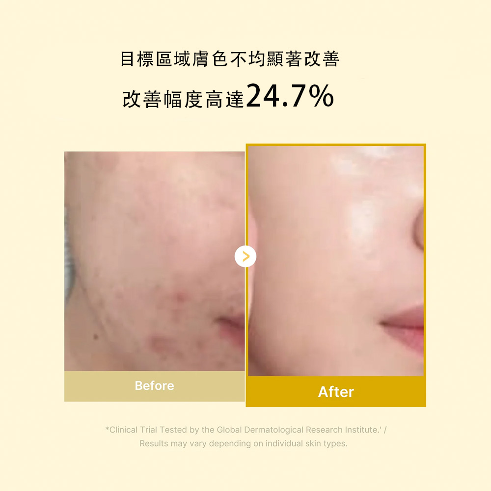 【台灣現貨】Medicube 全能麴酸薑黃撕拉面膜75ml 夜間修護撕拉面膜 睡眠面膜 提亮 膚色均勻 緊致肌膚 保濕 