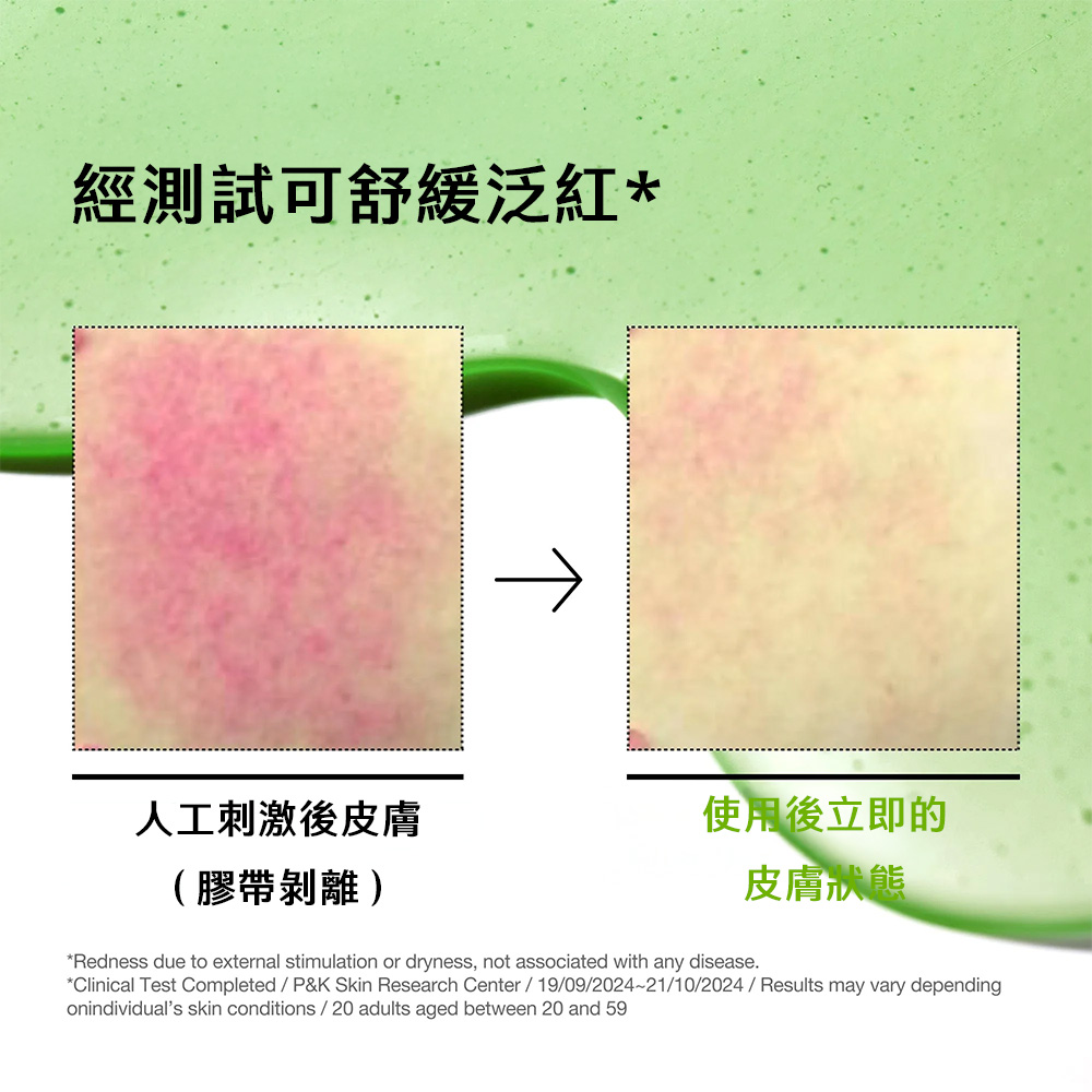 【台灣現貨】Anua 壬二酸10+玻尿酸抗痘抗紅修護/壬二酸15+積雪草精華液30ml 提亮 控油 舒緩保濕 改善泛紅