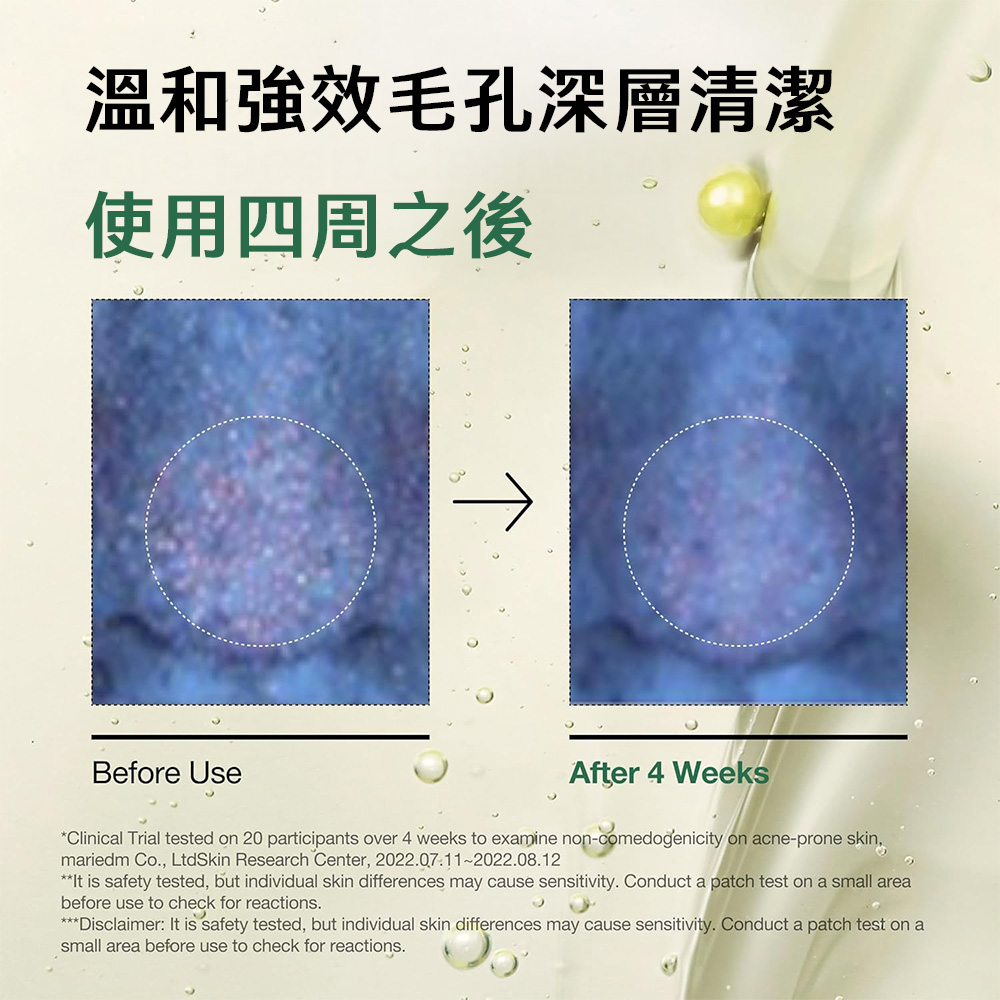 【台灣現貨】Anua Heartleaf魚腥草毛孔控制卸妝油 200ml 潔面油 清潔毛孔 毛孔護理 溫和不刺激