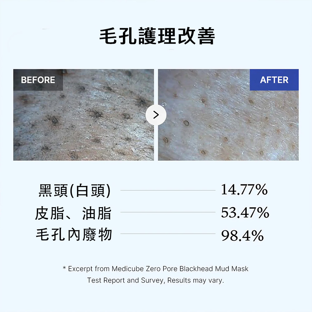 【台灣現貨】Medicube ZERO毛孔去黑頭泥膜100g 控油 緊緻毛孔 深入清潔