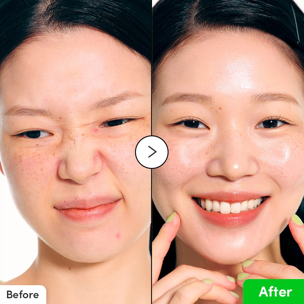 【台灣現貨】EQQUALBERRY 蘆薈PDRN保濕舒緩精華液30ml 快速舒緩 鎮靜肌膚 增強肌膚屏障