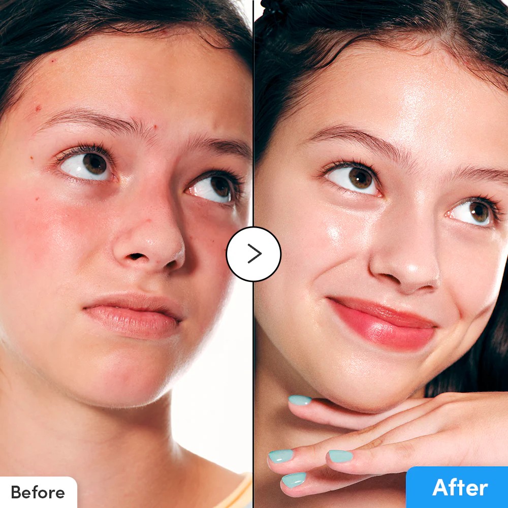 【台灣現貨】EQQUALBERRY 玻尿酸豐盈精華液30ml 深層持久保濕 強化皮膚屏障 舒緩