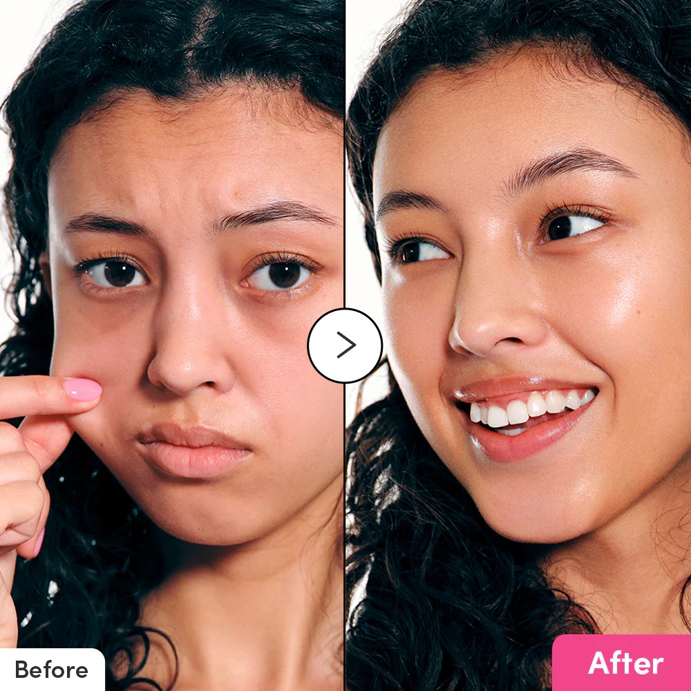 【台灣現貨】EQQUALBERRY NAD+肽增强精華液30ml 延緩老化 改善細紋 修護肌膚 維持彈性 保濕