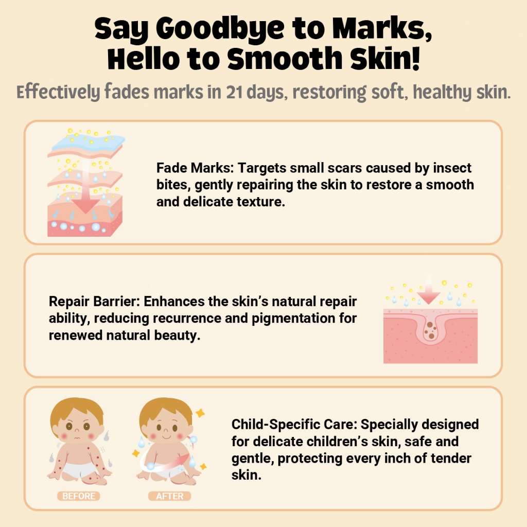Hegerbaby Spotbye Twinkle Glow Gel - Mosquito Bite Scar Repair Cream for Kids, Safe, Non-Toxic 15ml