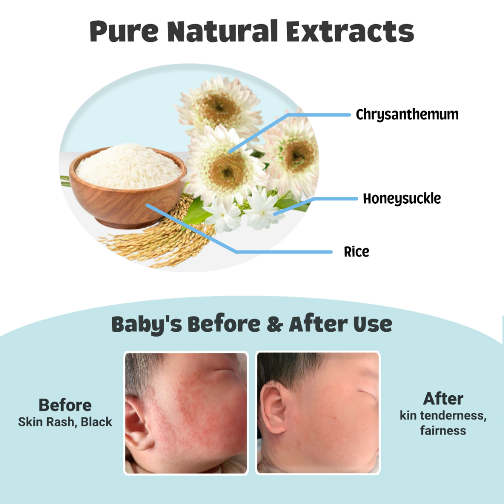 Hegerbaby RicePure Baby Lotion Prickly Heat Relief Trial Pack (1 piece 1.5ml) - Travel Essential