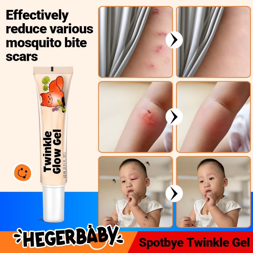 Hegerbaby Spotbye Twinkle Glow Gel - Mosquito Bite Scar Repair Cream for Kids, Safe, Non-Toxic 15ml