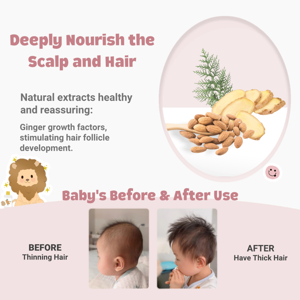 Hegerbaby Lotion + Lip Balm + Hair Oil - Relieves Prickly Heat & Saliva Rash & Moisturizes Scalp