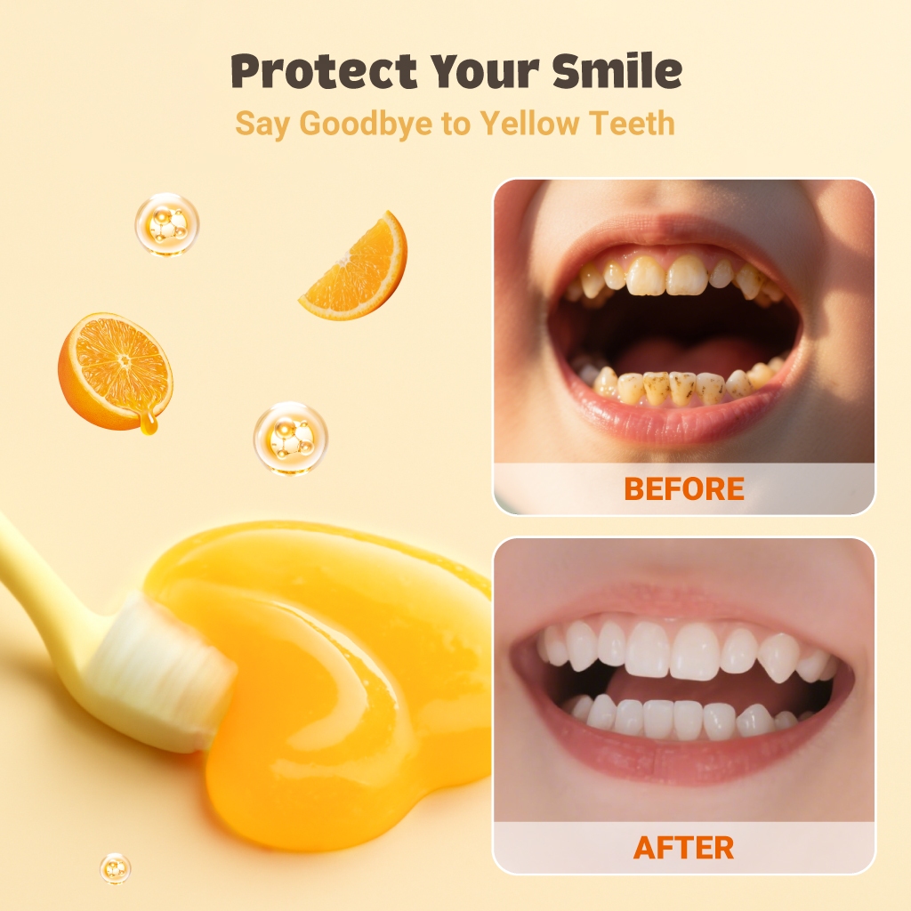 Hegerbaby Kiddieteeth Defender Toothpaste -  Kids Fluoride Whitening Milk Teeth 60g