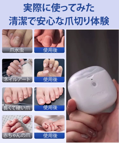 【安心設計】❣️SoftNail™ 電動ネイルスムーザー - 3分で完璧な仕上がり！割れ・引っかかりゼロ！