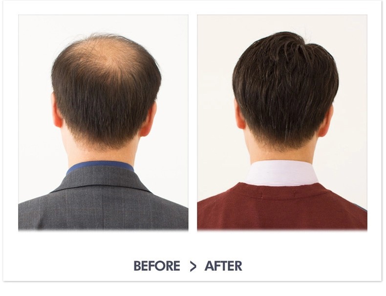 假发男中老年短发遮白发光头真发男士真人发丝假发套显年轻