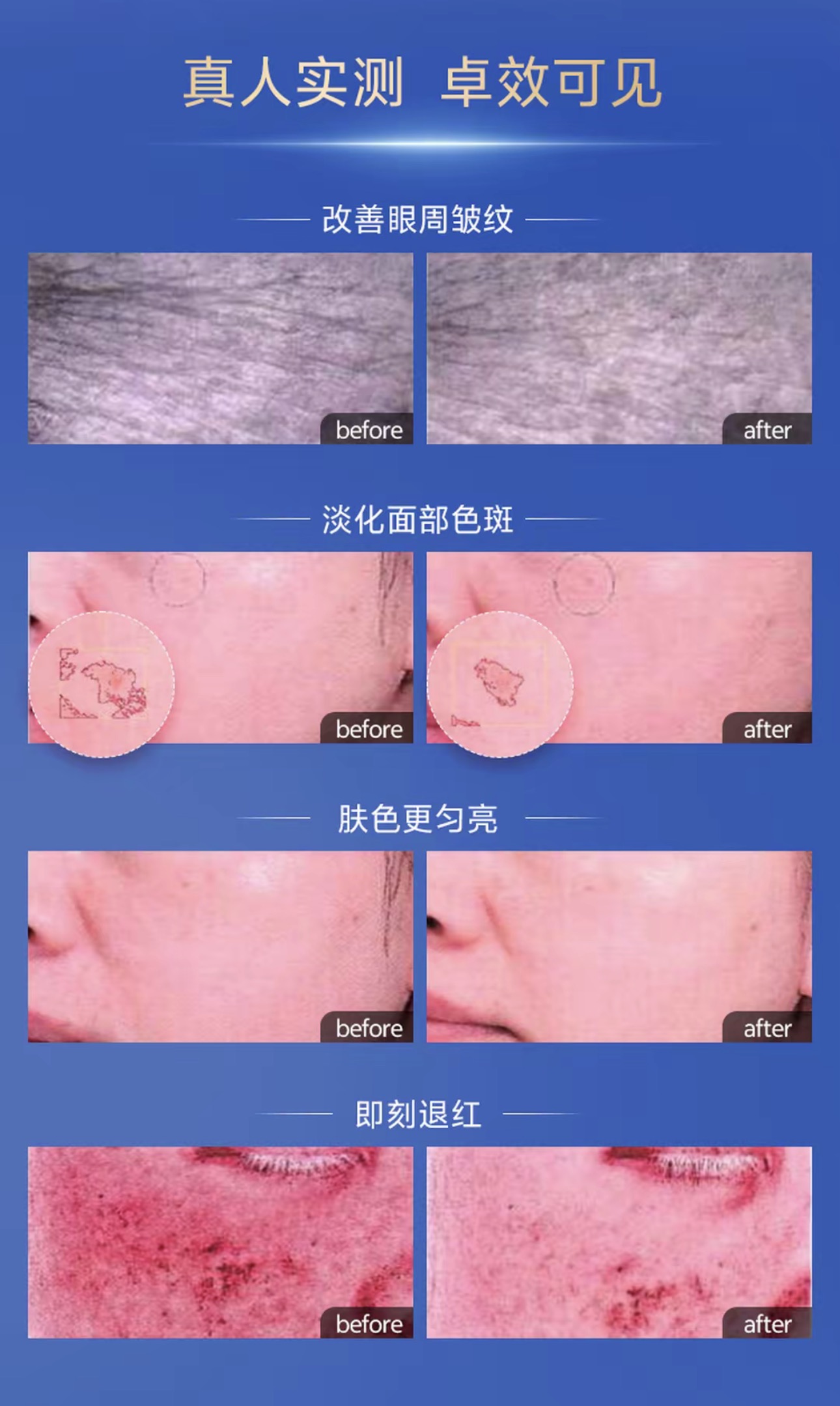 Wlead 超光炮亮白補水緊緻面膜