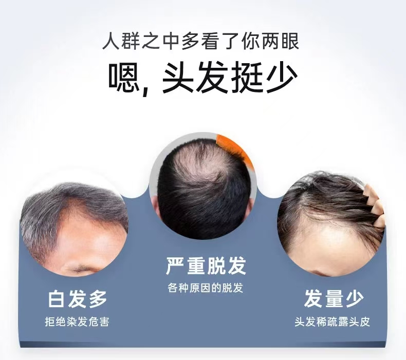 【送给爸爸的礼物】 假发男中老年假发全头套式短发男士帅气真人发自然透气假发套