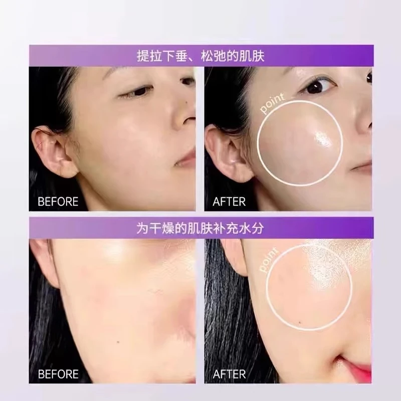 【ally专属】美蒂菲九肽抗皱紧致提拉面膜