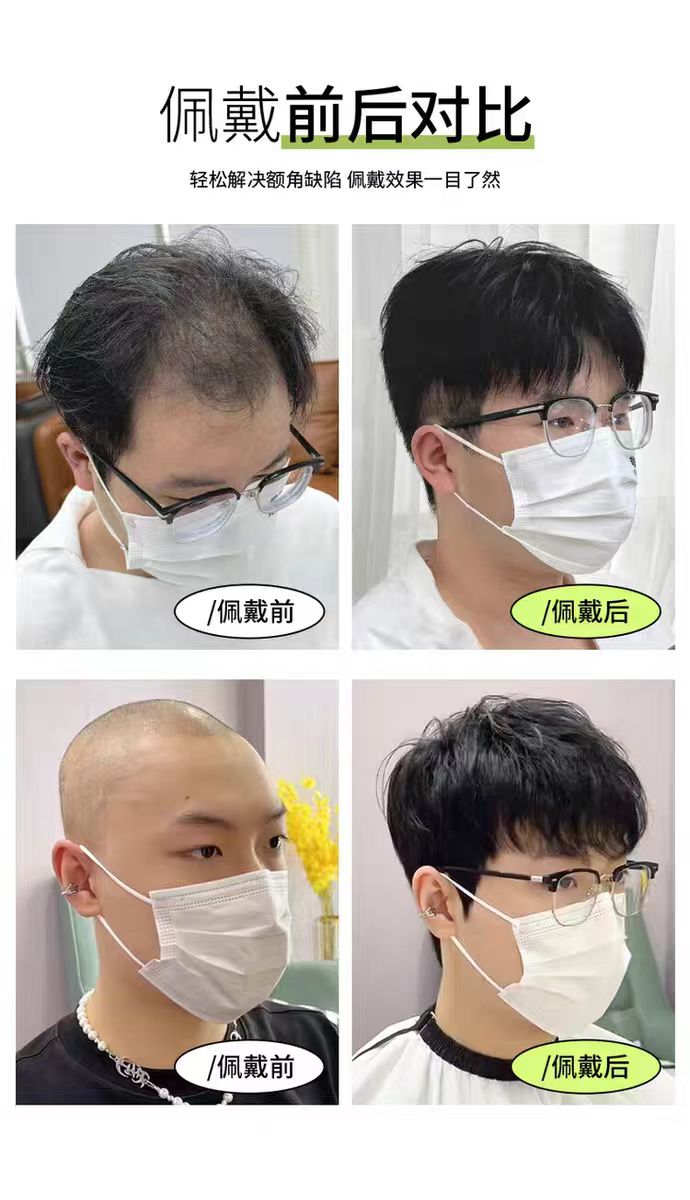 假发男短发潮流男士碎盖钢夹烫全真人发丝隐形头顶补发自然假发套
