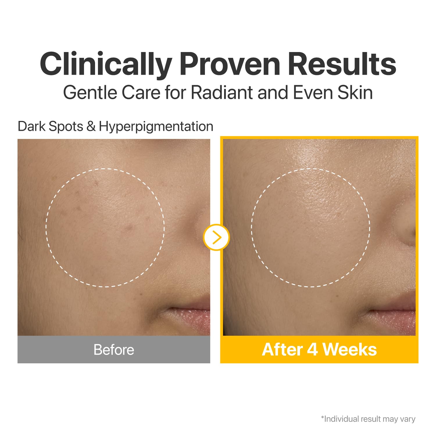 Numbuzin No.5 維生素濃縮精華液