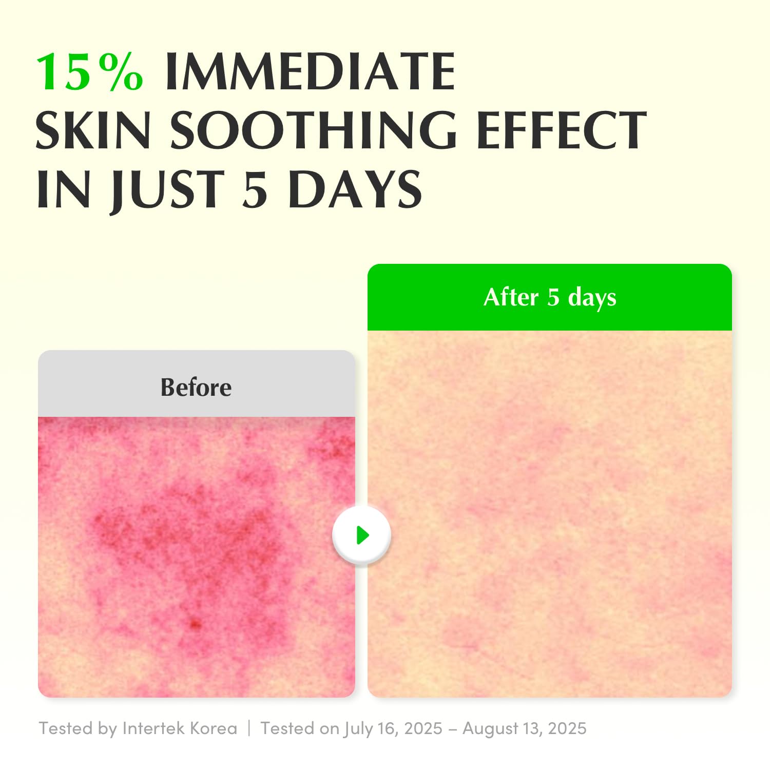 EQQUALBERRY 蘆薈積雪草舒緩精華液 30ml