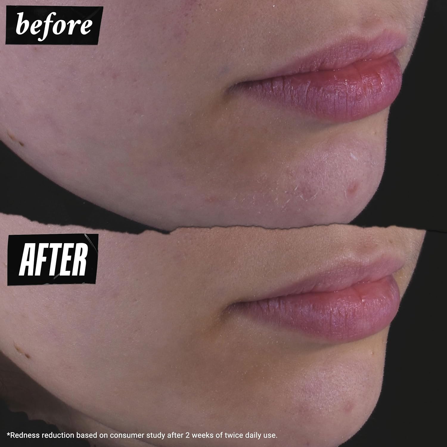 Kiehl's契爾氏 金盞花草本萃取無酒精爽膚水 500ml