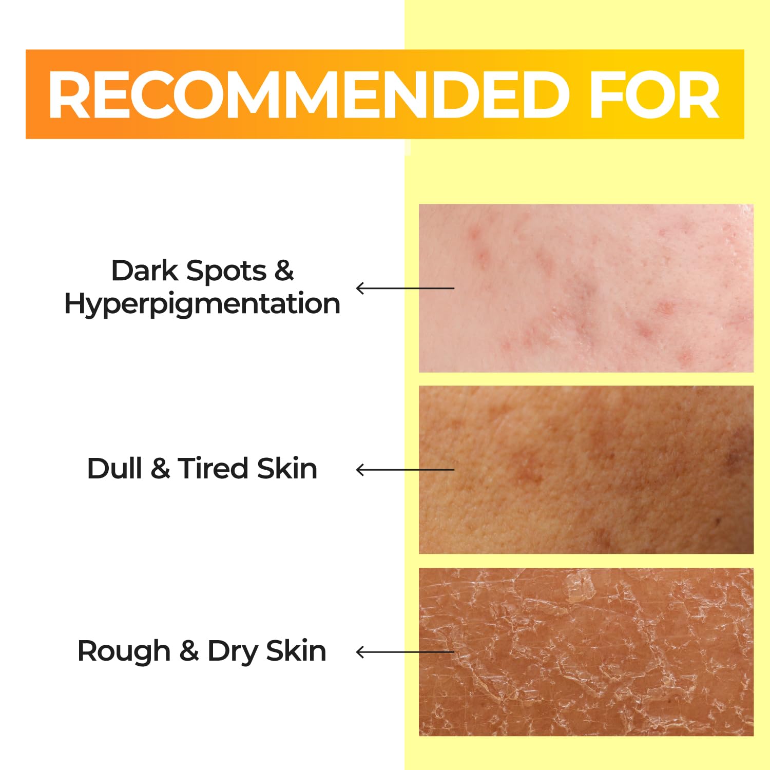 numbuzin No.5 維生素賦活精華爽膚水