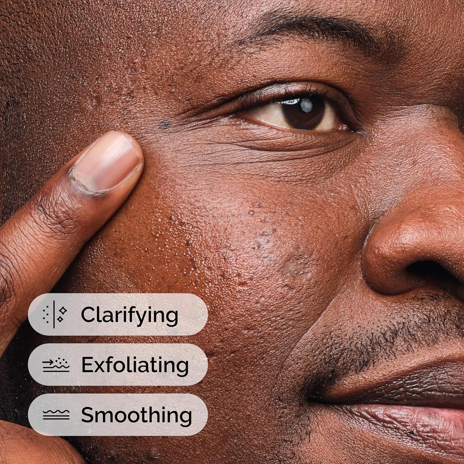 The Ordinary 2%水楊酸祛痘精華 30ml