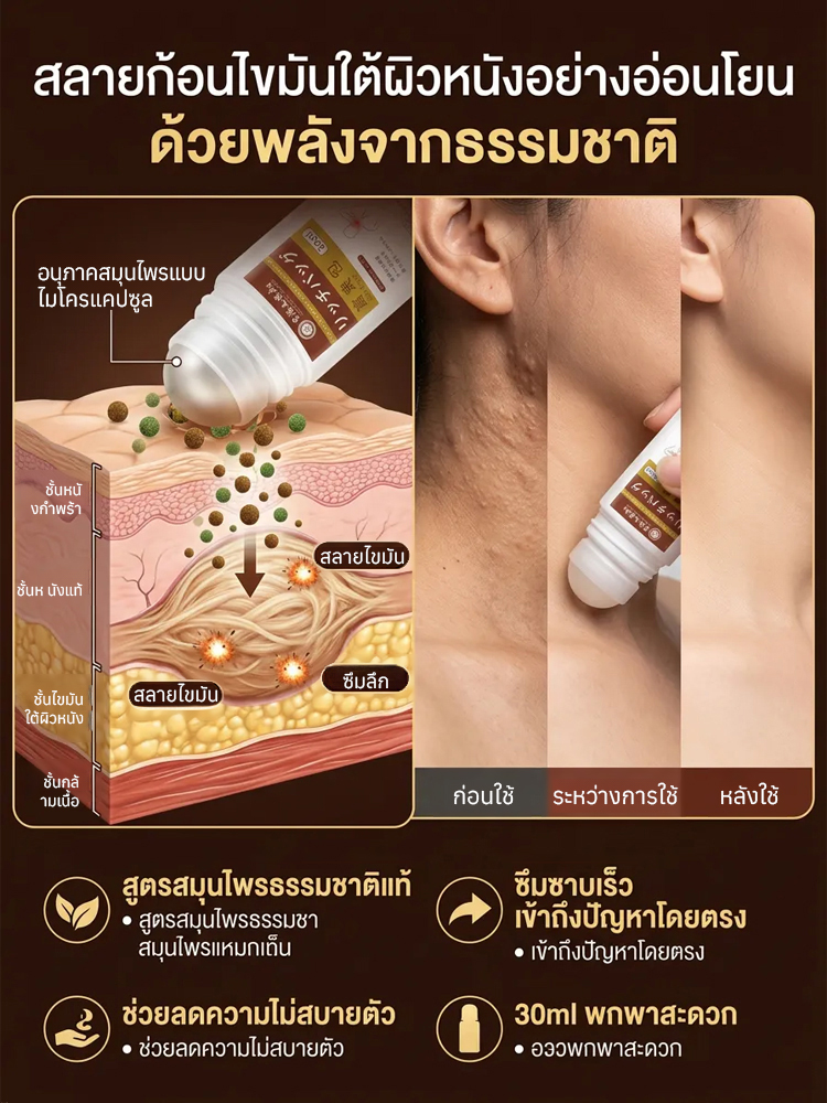 ก้อนไขมันลูกกลิ้ง