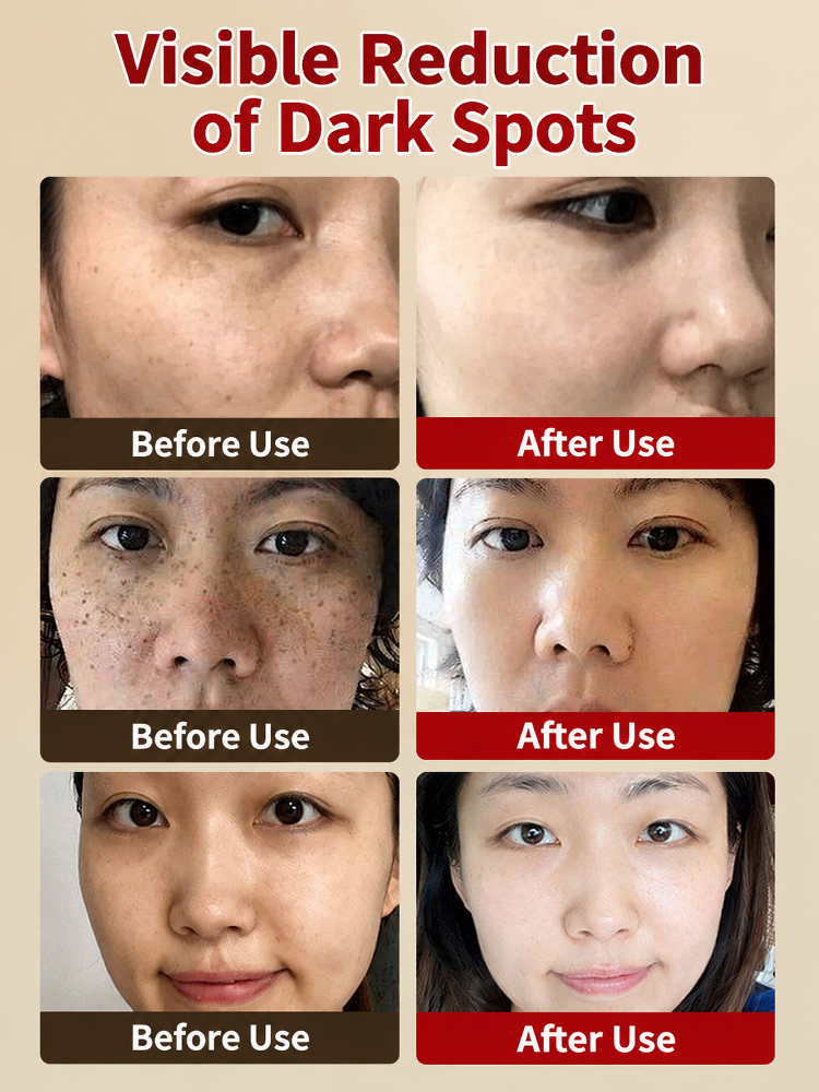 [Instant Skin Smoothing, Flawless Complexion] Whitening and Spot-Removing Skin Smoothing Cream