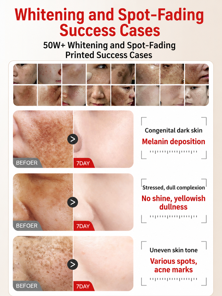 [Instant Skin Smoothing, Flawless Complexion] Whitening and Spot-Removing Skin Smoothing Cream