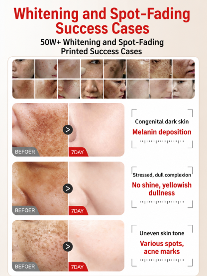 [Instant Skin Smoothing, Flawless Complexion] Whitening and Spot-Removing Skin Smoothing Cream