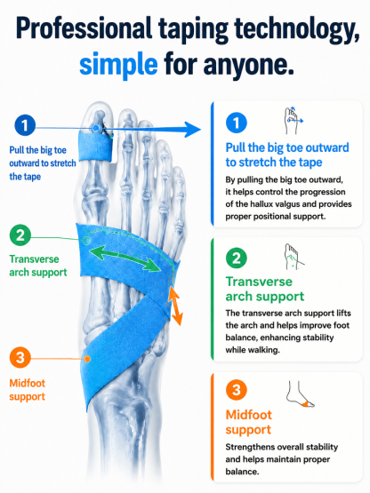 Hallux Valgus Correction Sports Bandage