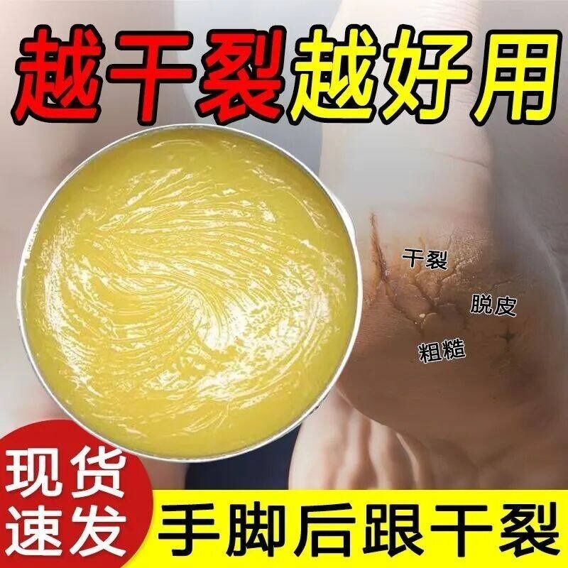 뒤꿈치 각질제거 크림 손발 튼살 케어 갈라진 피부 보습 마유 풋크림 고보습 영양