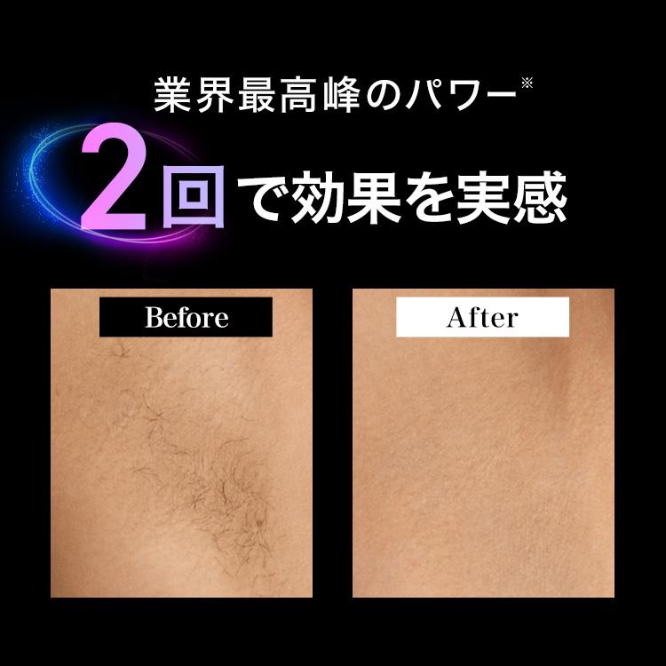 【90% OFF 激安！先着 200 名限定】脱毛器・光美容器を手掛けるブラウン シルクエキスパート  PL-5221 医療機関テスト済み  正規品 Braun  VIO メンズ 光  家庭用 ipl セルフ
