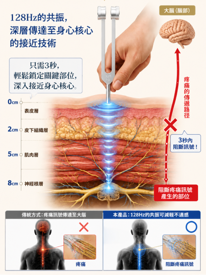 神戶的醫用神經治療音叉