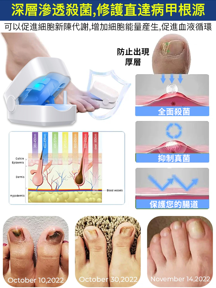 灰指甲光療機