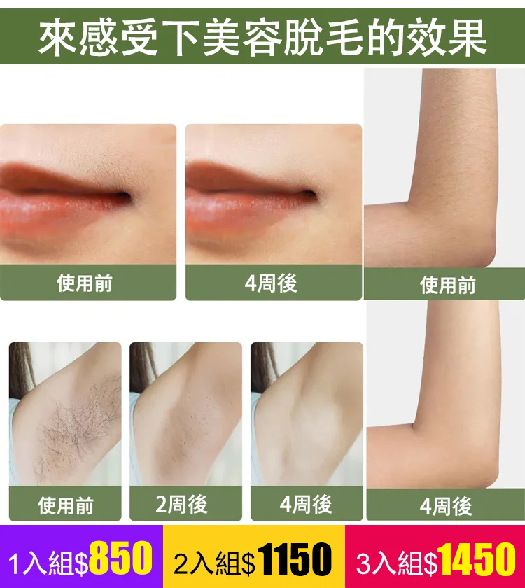 男女通用便攜激光脫毛儀