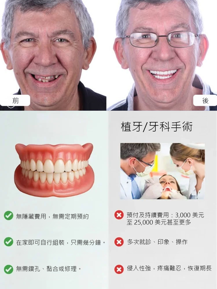 仿真自然牙齒義齒