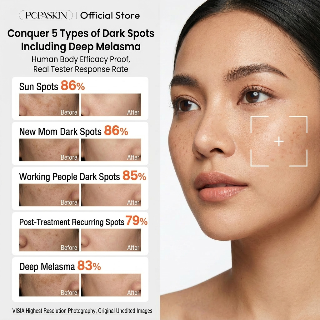 【✨POPASKIN 577+377 Intensive Dark Spot Correcting & Brightening Cream 30g✨】Suitable for sensitive skin, brightens the complexion, non-greasy, absorbs instantly, lightweight texture