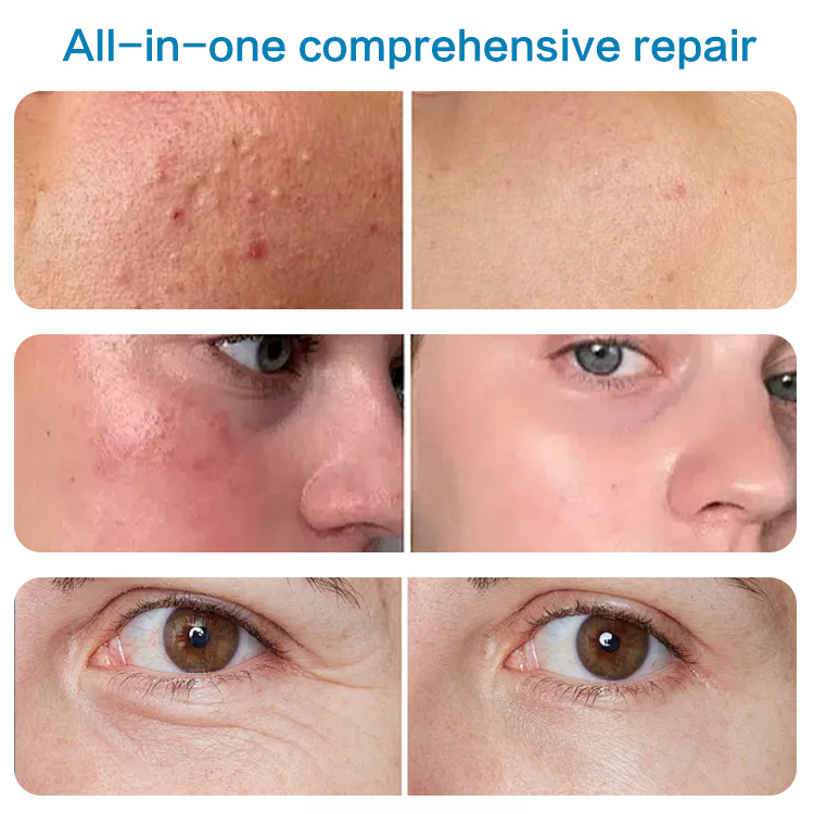 Ceramide & Prebiotic Barrier Stabilizer