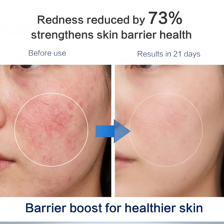 Ceramide & Prebiotic Barrier Stabilizer