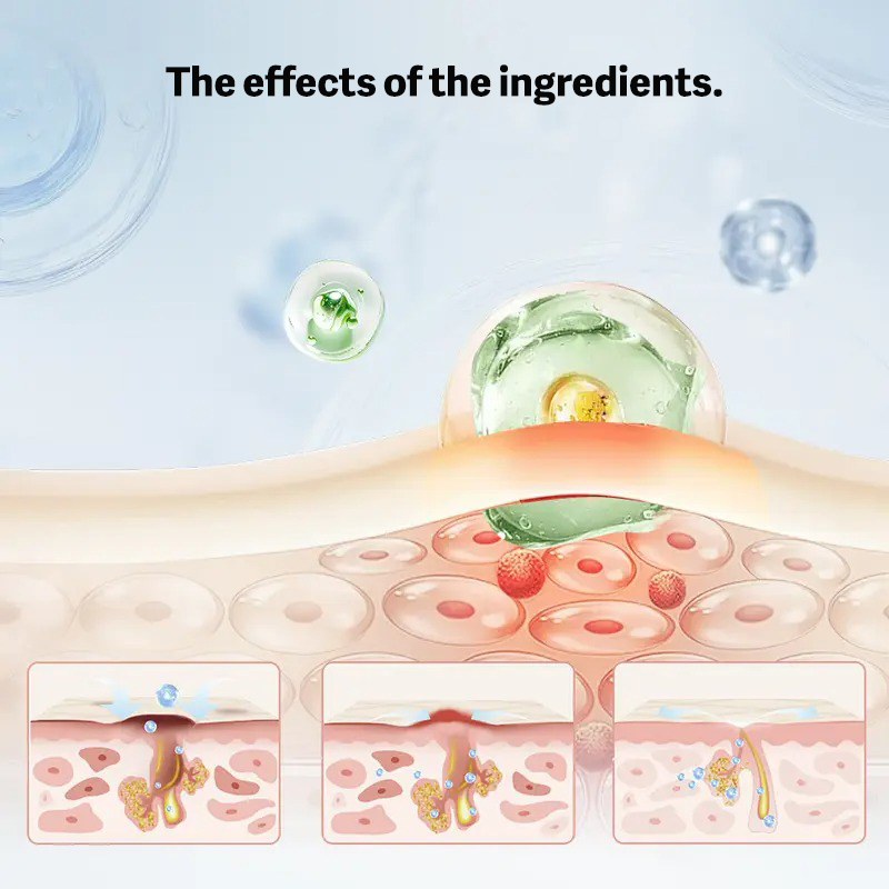 POPASKIN 2%BHA+MA ACNE CARE CALMING SERUM