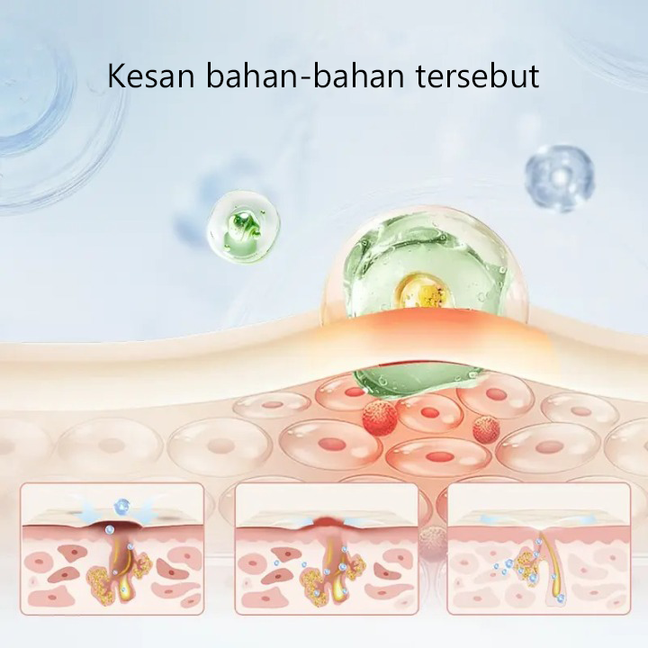 SERUM PENENANG PENJAGAAN JERAWAT POPASKIN 2%BHA+MA