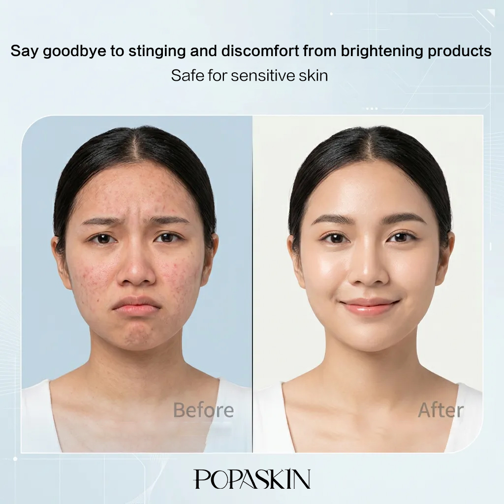 【KOL】 POPASKIN 5X Ceramide Barrier Soothing Moisturizer & 577 Dark Spot Cream: A skincare set for radiant skin, strengthening the skin barrier, reducing recurring acne, clearing dark spots, and revealing glass skin. Suitable for sensitive, acne-prone, and