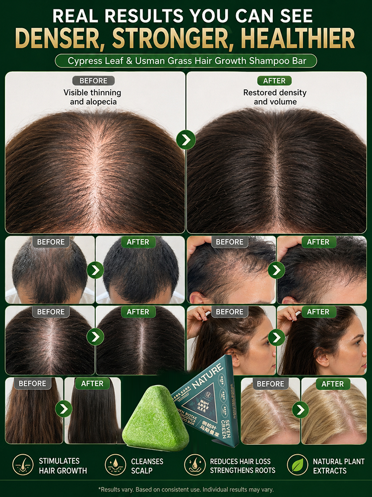[A Quick Fix - The Solution for Hair Loss]Usman Herbal Nourishing Repair Shampoo Soap